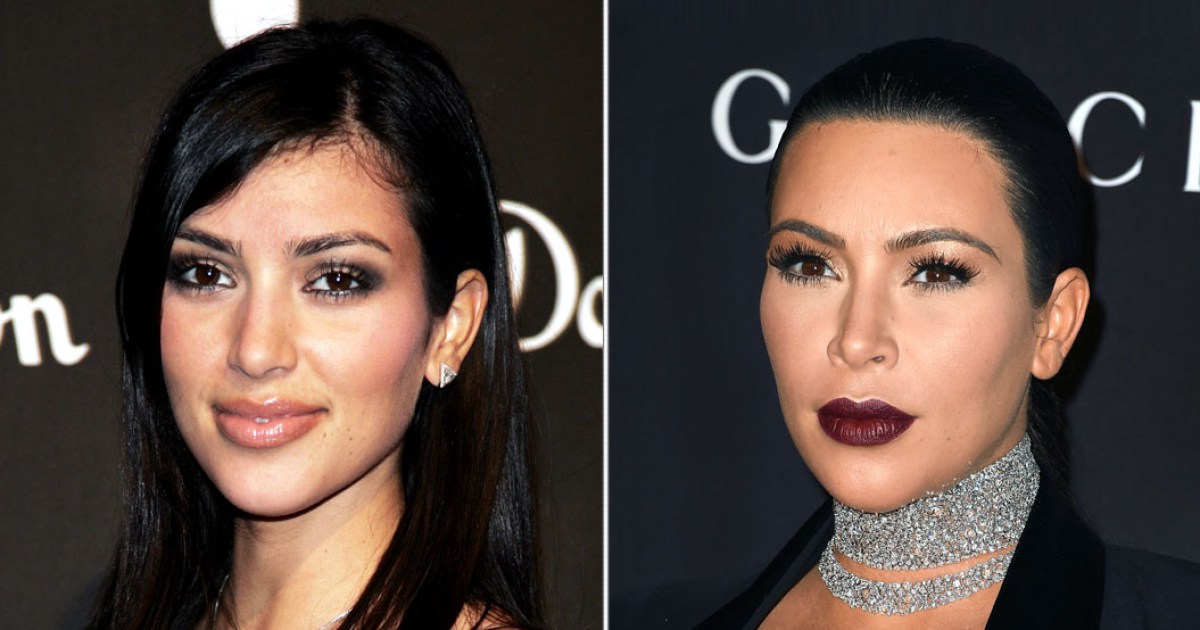Kim Kardashian Antes e Depois