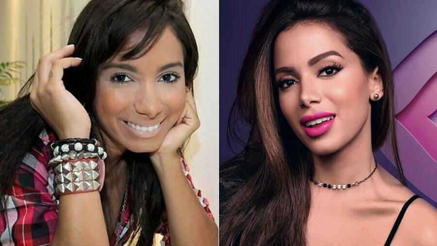antes e depois das celebridades Anitta 1