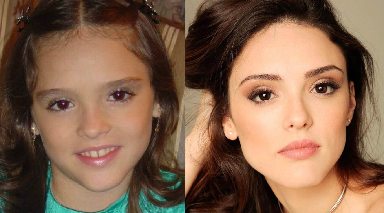 isabelle drummond antes e depois