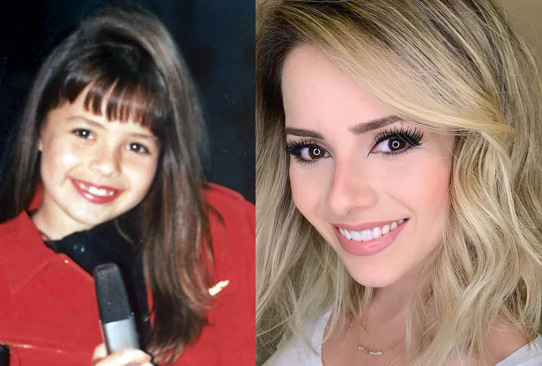 sandy antes e depois